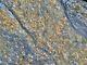 13 Lbs Of Genuine Gold, Silver, Copper Ore High Grade, Highly Mineralized Schist
